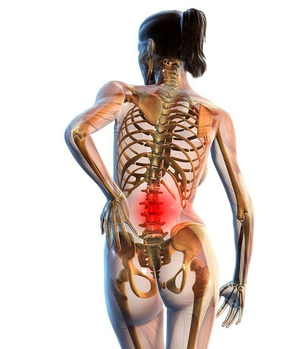 A osteocondrose da columna lumbar ocorre con máis frecuencia